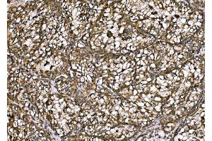 IHC analysis of DLAT using anti-DLAT antibody (ABIN7602307).