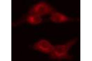 ABIN6269128 staining HeLa cells by IF/ICC. (MYB 抗体  (C-Term))