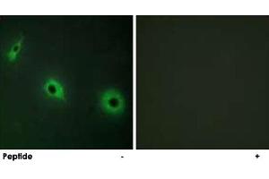 Immunofluorescence analysis of HepG2 cells, using CELSR3 polyclonal antibody . (CELSR3 抗体)