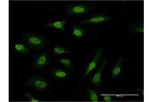 Immunofluorescence of monoclonal antibody to PDE3A on HeLa cell. (PDE3A 抗体  (AA 533-640))