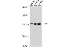 Western Blotting (WB) image for anti-Acid Phosphatase 5, Tartrate Resistant (ACP5) (AA 76-325) antibody (ABIN3016196)