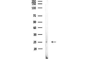 anti-Vesicle Transport through Interaction with T-SNAREs Homolog 1B (VTI1B) (Internal Region) antibody