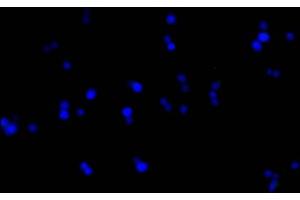 Immunofluorescence staining of 293F cells with ABIN7193151 at 1:100, counter-stained with DAPI. (HA-Tag 抗体)
