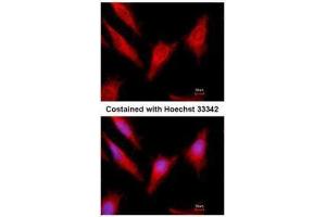 ICC/IF Image Immunofluorescence analysis of methanol-fixed HeLa, using Protein C, antibody at 1:500 dilution. (PROC 抗体)