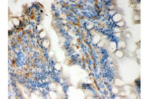 Anti- Galectin3 Picoband antibody, IHC(P) IHC(P): Rat Intestine Tissue (Galectin 3 抗体  (AA 153-264))