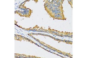 Immunohistochemistry of paraffin-embedded human prostate using CXCL11 antibody at dilution of 1:100 (40x lens). (CXCL11 抗体)