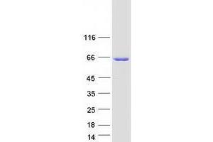 Western Blotting (WB) image for Transmembrane Protein 102 (TMEM102) protein (Myc-DYKDDDDK Tag) (ABIN2734158)