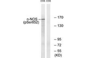 Western blot analysis of extracts from A549 cells, using n-NOS (Phospho-Ser852) Antibody. (NOS1 抗体  (pSer852))