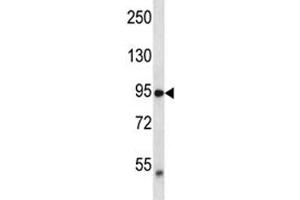 TRPV2 antibody western blot analysis in MDA-MB435 lysate. (TRPV2 抗体  (AA 52-81))