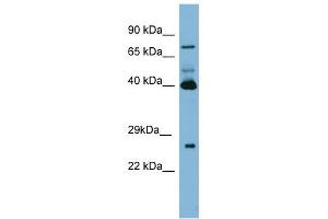 Transglutaminase 3 antibody used at 1 ug/ml to detect target protein. (TGM3 抗体)