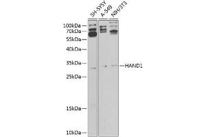 Western blot analysis of extracts of various cell lines, using H antibody (ABIN6128001, ABIN6141595, ABIN6141596 and ABIN6225185) at 1:1000 dilution. (HAND1 抗体  (AA 16-215))