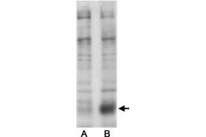 Western blot analysis of Phospho-Slc9a3 S605 in transfected COS-7 cells (Lane A. (SLC9A3 抗体  (pSer605))