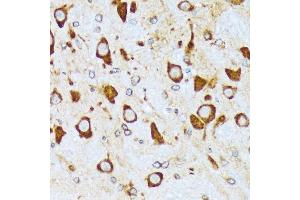 Immunohistochemistry (IHC) image for anti-Coatomer Protein Complex, Subunit alpha (COPA) antibody (ABIN7266423)