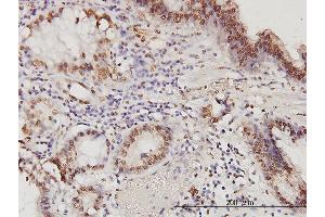 Immunostaining (ISt) image for anti-Proteasome (Prosome, Macropain) Activator Subunit 2 (PA28 Beta) (PSME2) (AA 1-90) antibody (ABIN562499)