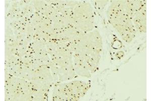 ABIN6276512 at 1/100 staining Mouse muscle tissue by IHC-P. (SMAD1 抗体  (Internal Region))