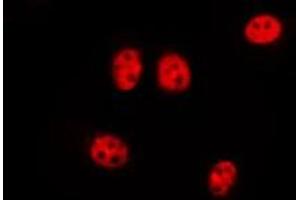 ABIN6277187 staining Hela by IF/ICC. (DNMT3L 抗体  (Internal Region))