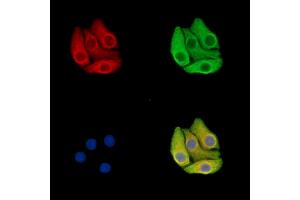 ABIN7096564 and ABIN7100628 staining Hela cells by IF/ICC.
