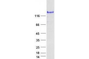 Western Blotting (WB) image for SPARC-Like 1 (Hevin) (SPARCL1) (Transcript Variant 1) protein (Myc-DYKDDDDK Tag) (ABIN2732506)