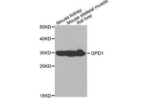 Western blot analysis of extracts of various tissues, using GPD1 antibody.