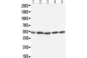 Anti-TIM 1 antibody, Western blotting Lane 1: SMMC Cell Lysate Lane 2: HELA Cell Lysate Lane 3: PANC Cell Lysate Lane 4: M231 Cell Lysate Lane 5: M453 Cell Lysate (HAVCR1 抗体  (C-Term))