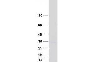 Western Blotting (WB) image for RAB3A, Member RAS Oncogene Family (RAB3A) protein (Myc-DYKDDDDK Tag) (ABIN2730348)