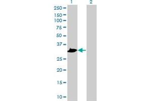 Western Blot analysis of PRPS1 expression in transfected 293T cell line by PRPS1 polyclonal antibody (A01). (PRPS1 抗体  (AA 1-100))