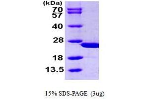 SDS-PAGE (SDS) image for Calcyphosine (CAPS) (AA 1-189) protein (His tag) (ABIN667359) (Calcyphosine Protein (CAPS) (AA 1-189) (His tag))