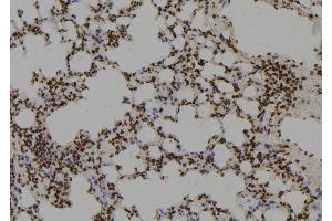 ABIN6279755 at 1/100 staining Mouse lung tissue by IHC-P. (RGS17 抗体  (N-Term))