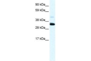 Western Blotting (WB) image for anti-Annexin A3 (ANXA3) antibody (ABIN2461372) (Annexin A3 抗体)