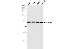 WB Image GSPT1 antibody detects GSPT1 protein by western blot analysis. (GSPT1 抗体)