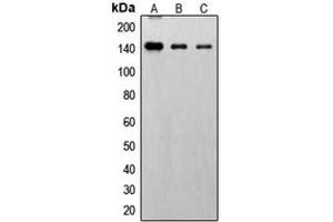 Western blot analysis of FGFR1 (pY766) expression in HepG2 EGF-treated (A), SP2/0 EGF-treated (B), PC12 EGF-treated (C) whole cell lysates. (FGFR1 抗体  (C-Term, pTyr766))
