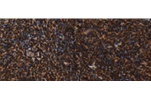 Immunohistochemistry of paraffin-embedded Human tonsil tissue using LMNB1 Polyclonal Antibody at dilution of 1:60(x200) (Lamin B1 抗体)