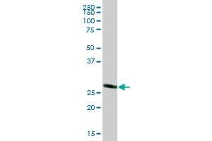 CACYBP MaxPab polyclonal antibody. (CACYBP 抗体  (AA 1-228))