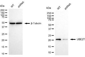 Western blotting analysis using UBE2T antibody (ABIN7800753). (Recombinant Ube2t 抗体)