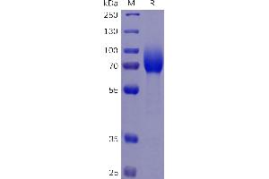 SDS-PAGE (SDS) image for Colony Stimulating Factor 1 Receptor (CSF1R) (AA 20-514) protein (His tag) (ABIN6961125)