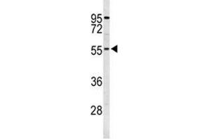 Western blot analysis of S6K2 antibody and K562 lysate. (RPS6KB2 抗体)