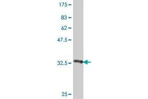 Western Blot detection against Immunogen (37 KDa) . (Netrin G2 抗体  (AA 21-119))