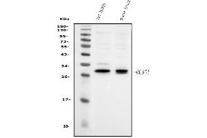 Western blot analysis of Olig1 using anti-Olig1 antibody (ABIN7599193).