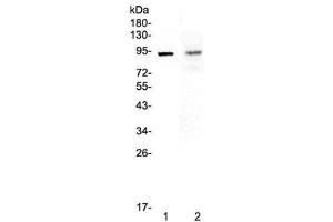 Western blot testing of 1) rat spleen and 2) mouse intestine lysate with TLR1 antibody at 0. (TLR1 抗体)