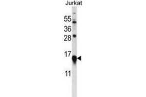 Western blot analysis in Jurkat cell line lysates (35ug/lane) using MYL9 Antibody (C-term).