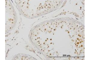 Image no. 1 for anti-Interleukin-1 Receptor-Associated Kinase 4 (IRAK4) (AA 1-130) antibody (ABIN599243) (IRAK4 抗体  (AA 1-130))