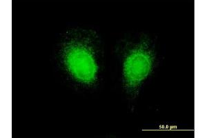 Immunofluorescence of purified MaxPab antibody to CSF2 on HeLa cell. (GM-CSF 抗体  (AA 1-144))