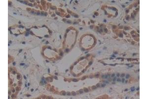 Immunohistochemistry (IHC) image for anti-Protein Kinase C, iota (PRKCI) (AA 375-596) antibody (ABIN7444109)