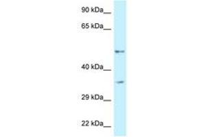 Image no. 1 for anti-6-phosphofructo-2-Kinase/fructose-2,6-Biphosphatase 1 (PFKFB1) (AA 335-384) antibody (ABIN6747350) (PFKFB1 抗体  (AA 335-384))