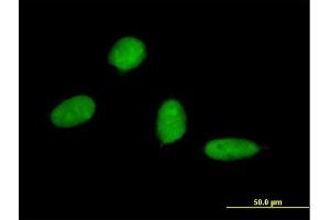 Immunofluorescence of monoclonal antibody to SP7 on HeLa cell. (SP7 抗体  (AA 87-162))