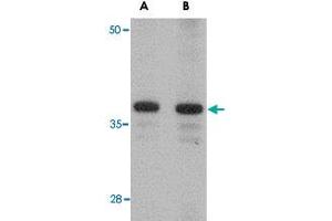 Western blot analysis of CDCA8 in rat kidney tissue lysate with CDCA8 polyclonal antibody  at (A) 1 and (B) 2 ug/mL . (CDCA8 抗体  (N-Term))