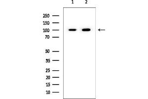 anti-FAST Kinase Domains 1 (FASTKD1) (Internal Region) antibody