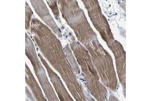 Immunohistochemical staining (Formalin-fixed paraffin-embedded sections) of human skeletal muscle with PANK4 polyclonal antibody  shows moderate cytoplasmic positivity. (PANK4 抗体)