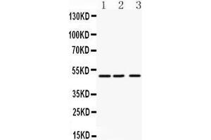 Anti- ANGPTL4 antibody, Western blotting All lanes: Anti ANGPTL4  at 0. (ANGPTL4 抗体  (C-Term))