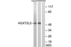 Western blot analysis of extracts from K562/HepG2 cells, using AGXT2L2 Antibody. (AGXT2L2 抗体  (AA 341-390))